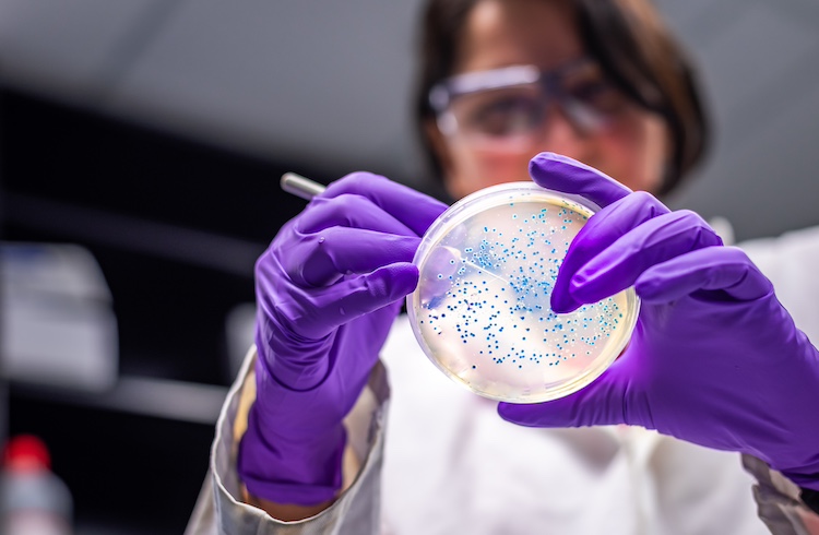 woman researcher performing examination of bacterial culture plate